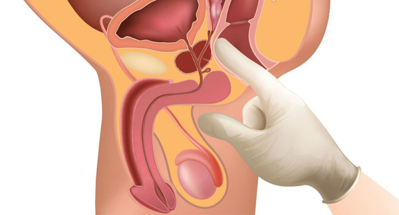 простатит массаж